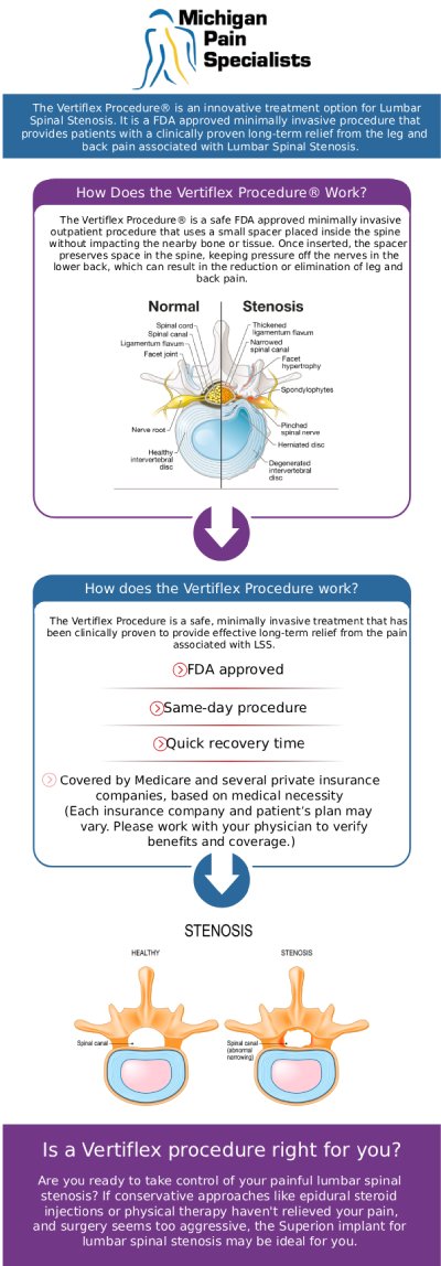 Common questions asked by patients: What is the Vertiflex procedure? How does the Vertiflex procedure relieve spinal stenosis pain? Who is a good candidate for the Vertiflex procedure? How long does recovery take after a Vertiflex implant? Insights from Our Board-Certified Doctors. For more information, contact us or request an appointment online. We are conveniently located at 710 Avis Dr #200, Ann Arbor, MI 48108. We serve patients from Ann Arbor MI, Saline MI, Ypsilanti MI, Dexter MI, and surrounding areas. Common questions asked by patients: What is the Vertiflex procedure? How does the Vertiflex procedure relieve spinal stenosis pain? Who is a good candidate for the Vertiflex procedure? How long does recovery take after a Vertiflex implant? Insights from Our Board-Certified Doctors. For more information, contact us or request an appointment online. We are conveniently located at 710 Avis Dr #200, Ann Arbor, MI 48108. We serve patients from Ann Arbor MI, Saline MI, Ypsilanti MI, Dexter MI, and surrounding areas.